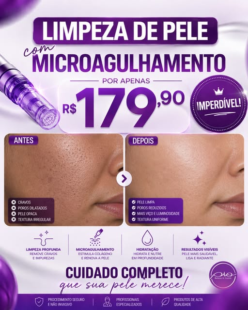 Post da Clínica PIO sobre limpeza de pele com microagulhamento