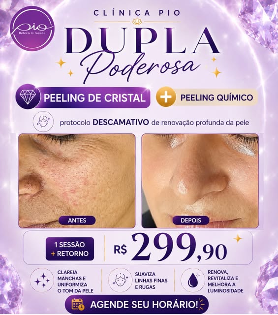Post da Clínica PIO sobre peeling de cristal e peeling químico